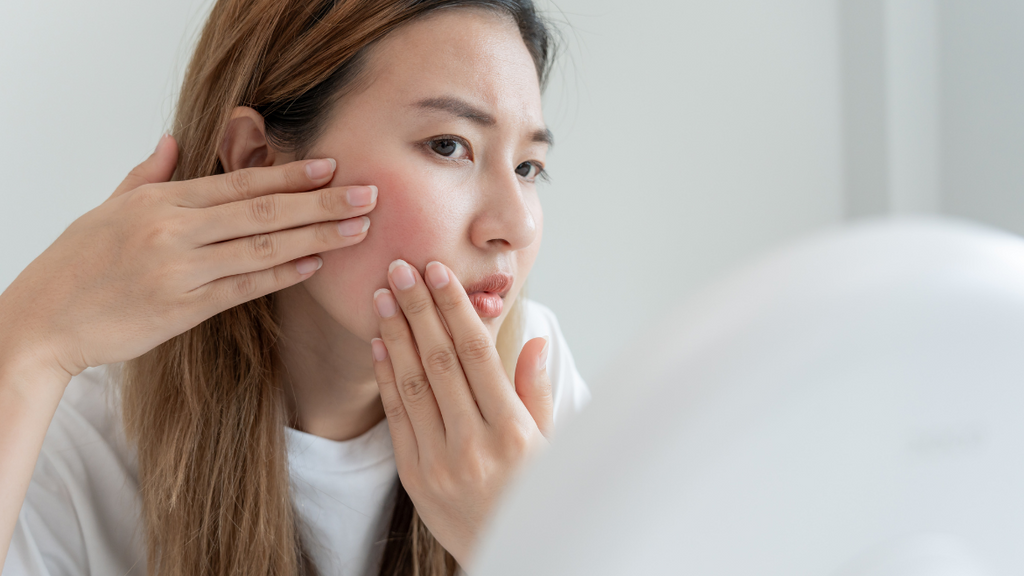 How To Treat And Prevent Breakouts